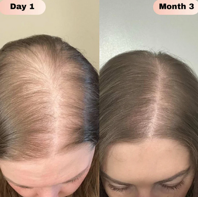 Advanced Natural Hair Growth Roll-On Serum