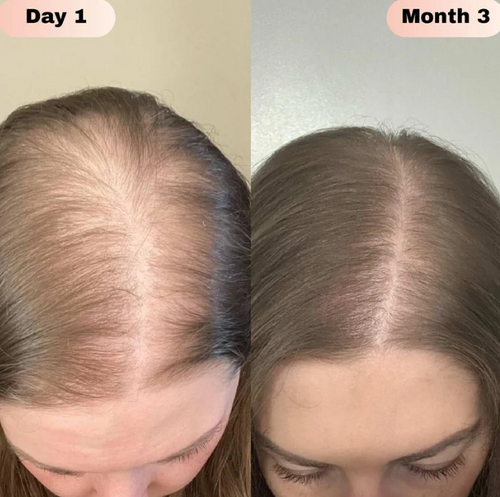 Advanced Natural Hair Growth Roll-On Serum