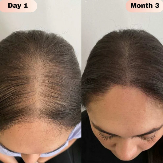 Advanced Natural Hair Growth Roll-On Serum